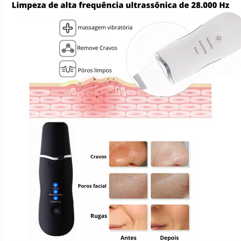 Espátula Peeling Ultrassônico-Para Cravos